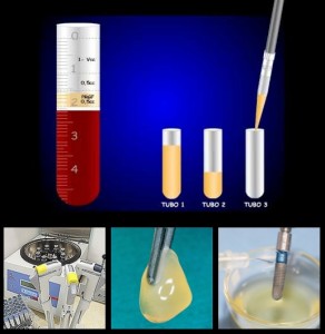 Estética dentofacial con implantes